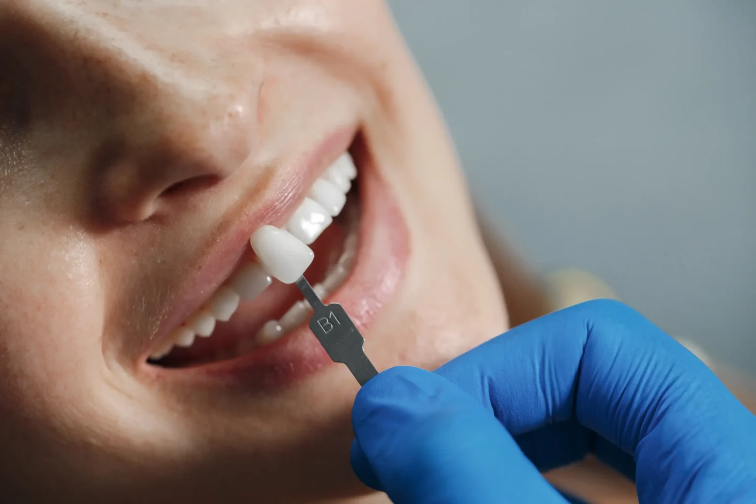 Permanent dental implants provided by dental clinic thalassery