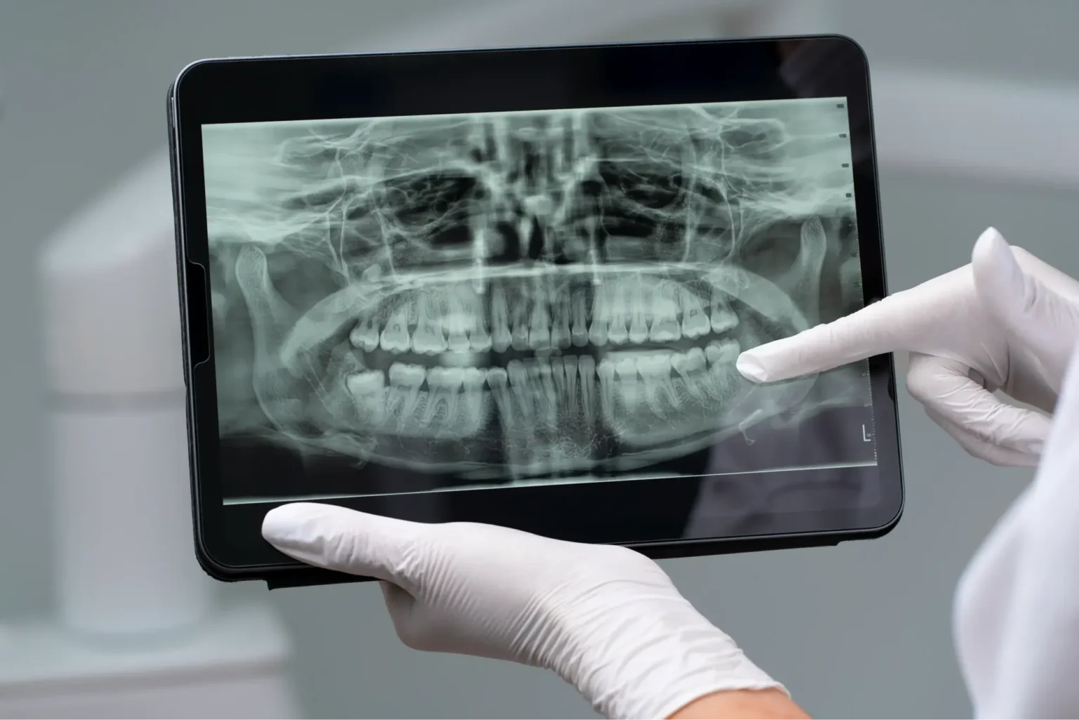 Digital dental X-Ray and RVG imaging at dental clinic thalassery