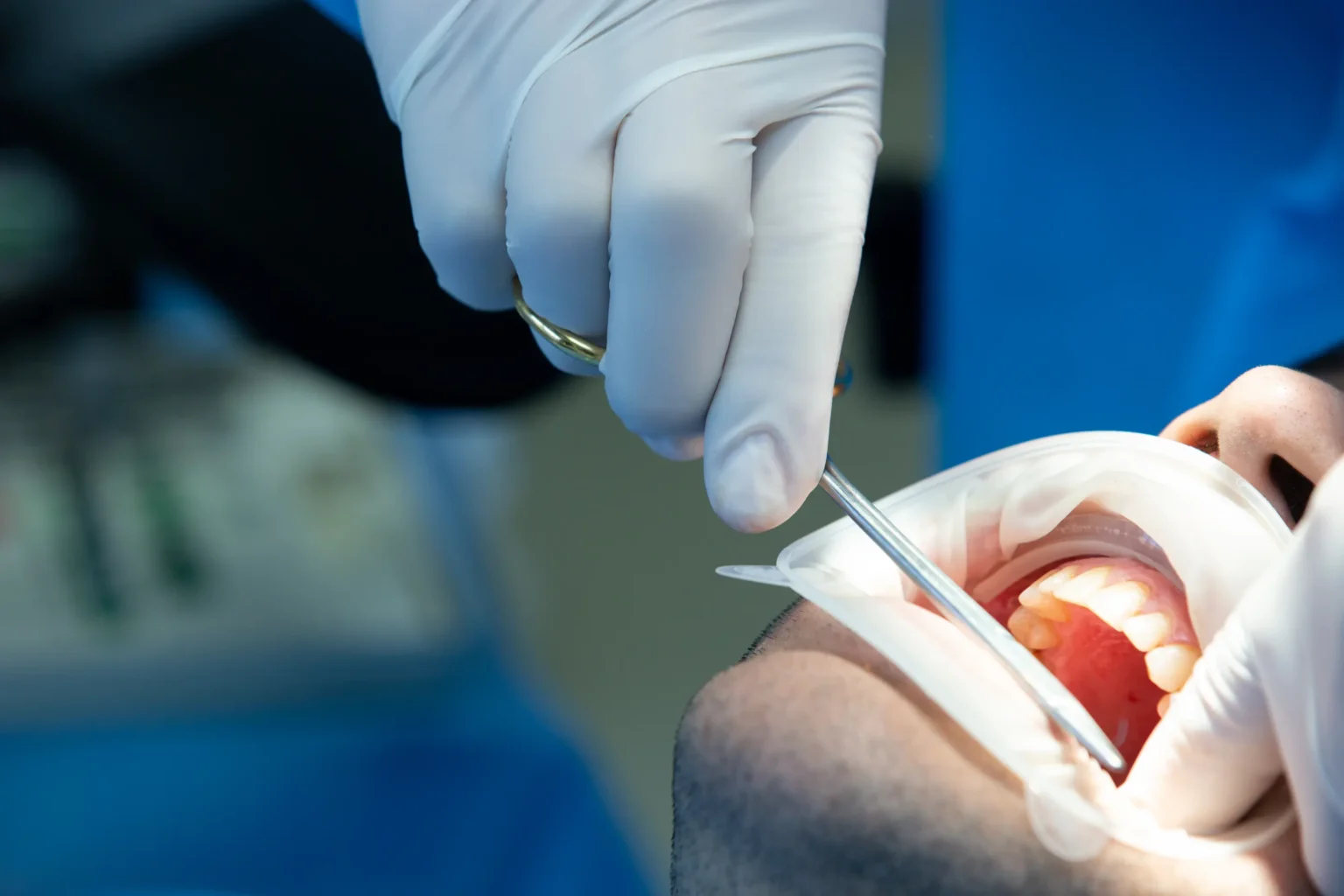 Oral Surgery & Tooth Extractions